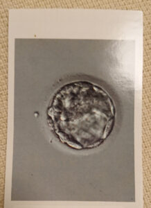5日目　胚盤胞　画像